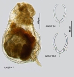 Asplanchnopus hyalinus