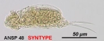 Cephalodella elegans