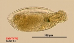 Trichocerca voluta