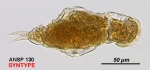 Cephalodella eunoma