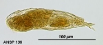 Notommata fasciola