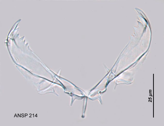 Asplanchna priodonta