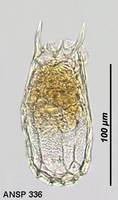 Keratella reducta