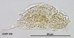 Cephalodella compacta