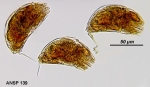 Trichocerca inermis