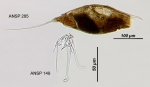 Trichocerca longiseta