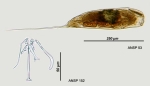Trichocerca elongata