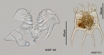 Plationus patulus macracanthus