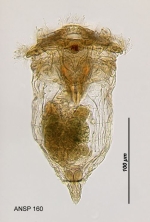 Synchaeta tremula