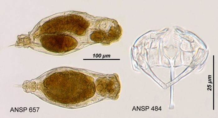 Notommata diasema