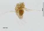 Hexarthra oxyure