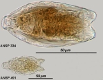 Anuraeopsis navicula