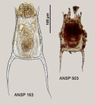 Keratella quadrata var. frenzeli