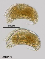 Trichocerca weberi