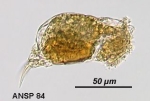 Cephalodella globata