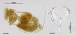 Cephalodella tenuiseta