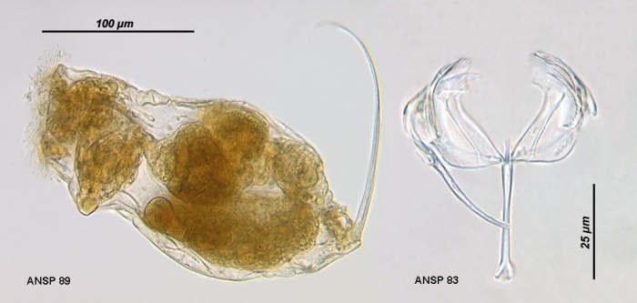 Cephalodella tenuiseta