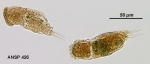 Cephalodella tenuior
