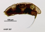 Trichocerca collaris