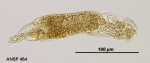 Notommata contorta