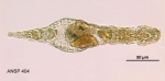 Adineta gracilis