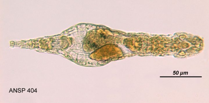 Adineta gracilis Adineta gracilis