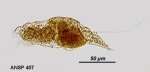 Squatinella retrospina