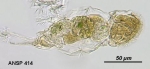 Cephalodella hyalina