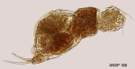 Cephalodella biungulata
