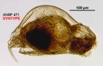 Euchlanis dilatata var. crassa