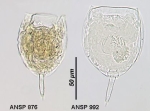 Lecane scutata