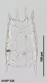 Keratella hiemalis