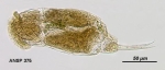 Cephalodella lepida