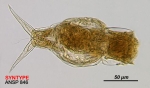 Cephalodella conjuncta