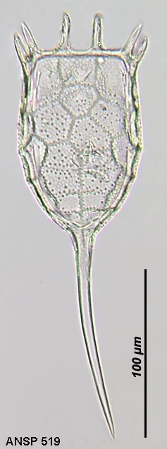 Keratella earlinae