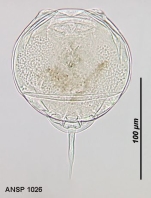 Lecane difficilis