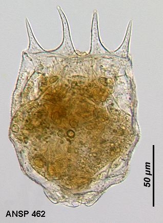 Brachionus budapestinensis Brachionus budapestinensis