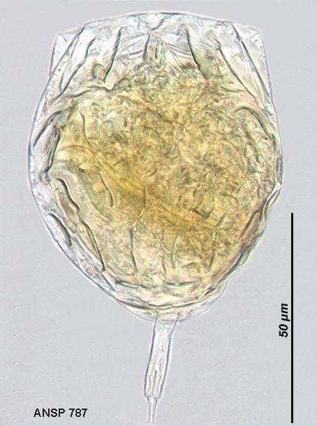Lecane inopinata