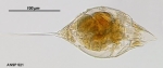 Trichocerca multicrinis