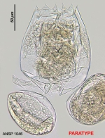 Brachionus ibericus