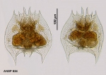 Brachionus quadridentatus f. brevispinus
