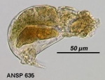 Cephalodella catellina f. ahlstromi