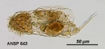 Cephalodella compressa