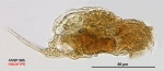 Cephalodella subsecunda