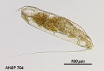 Trichocerca cylindrica