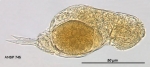 Cephalodella sterea