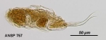 Cephalodella eva