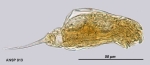 Cephalodella hiulca