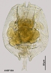 Brachionus angularis