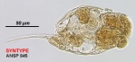 Cephalodella planera
